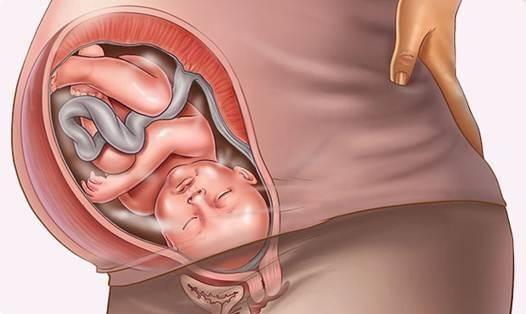 Se a testa di u fetu scende in a pelvis, quandu nasceraghju?