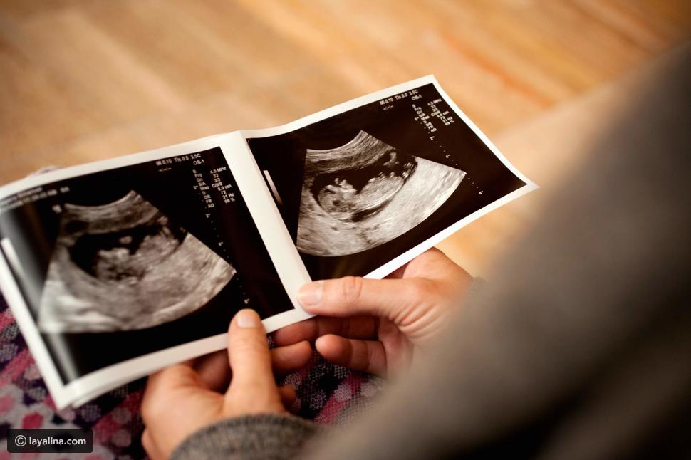 Sinais de gravidez com uma menina ou menino desde o primeiro mês