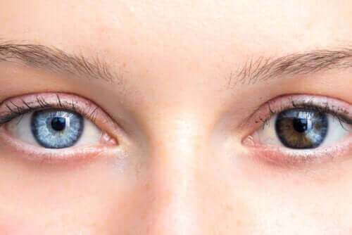 أمراض تؤدي إلى تغير لون العين