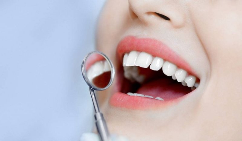 ما هي اسباب ضعف الاسنان؟