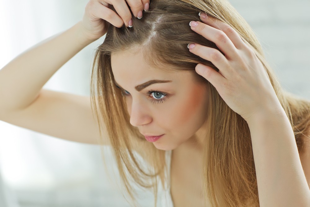 خلطات تساعد على التخلص من قشرة الشعر