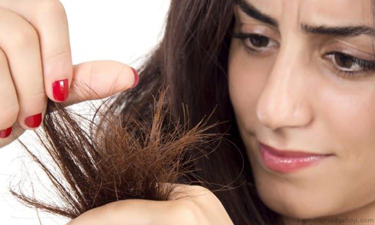 علاج تقصف الشعر من الامام بمكونات طبيعية