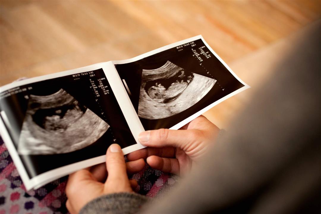 العلاقة بين النوم على الجانب الأيسر للحامل ونوع الجنين 