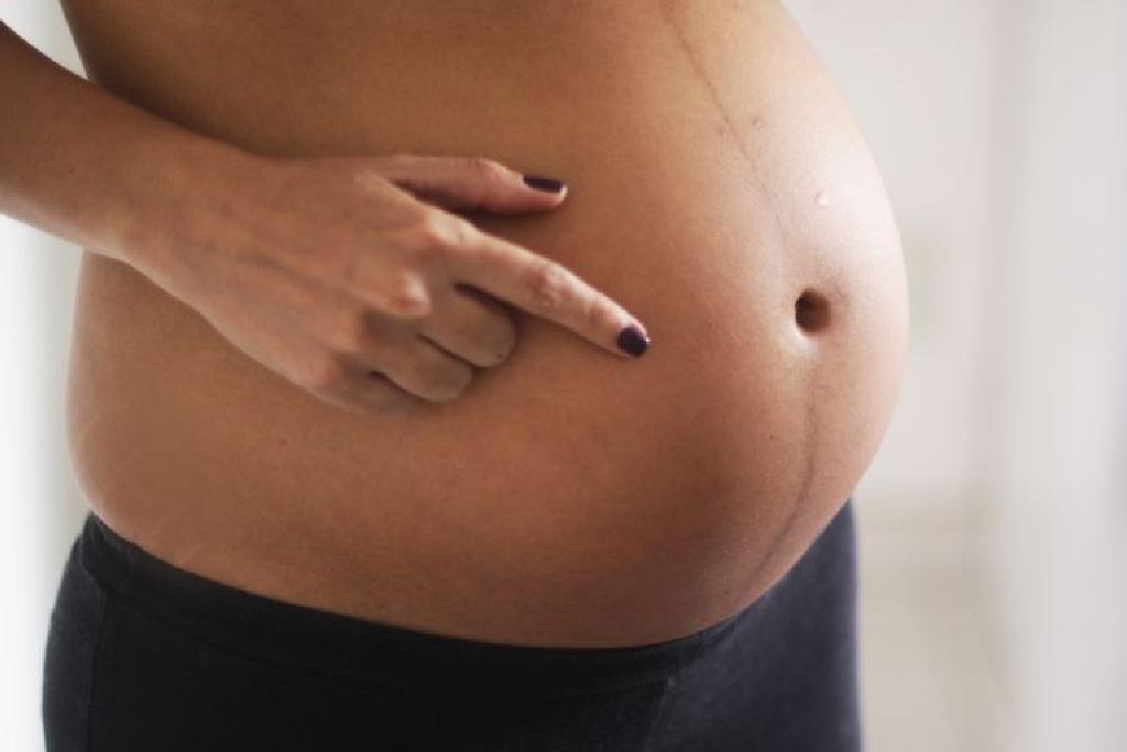 متى يظهر خط السرة للحامل؟