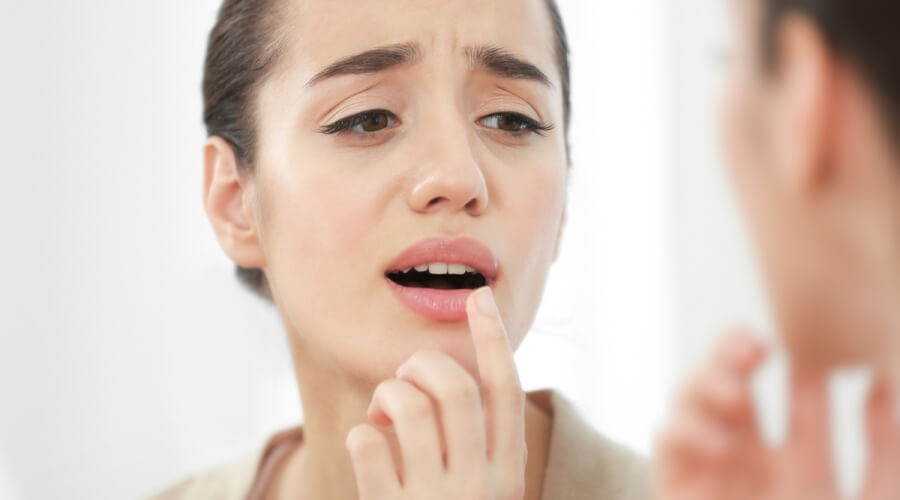 كيفية علاج تقرحات الفم بالملح 