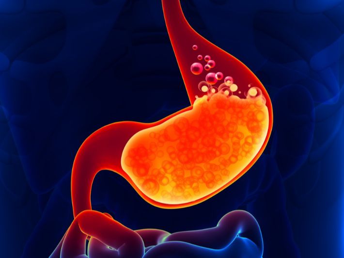 كيفية علاج حموضة المعدة بطرق طبيعية
