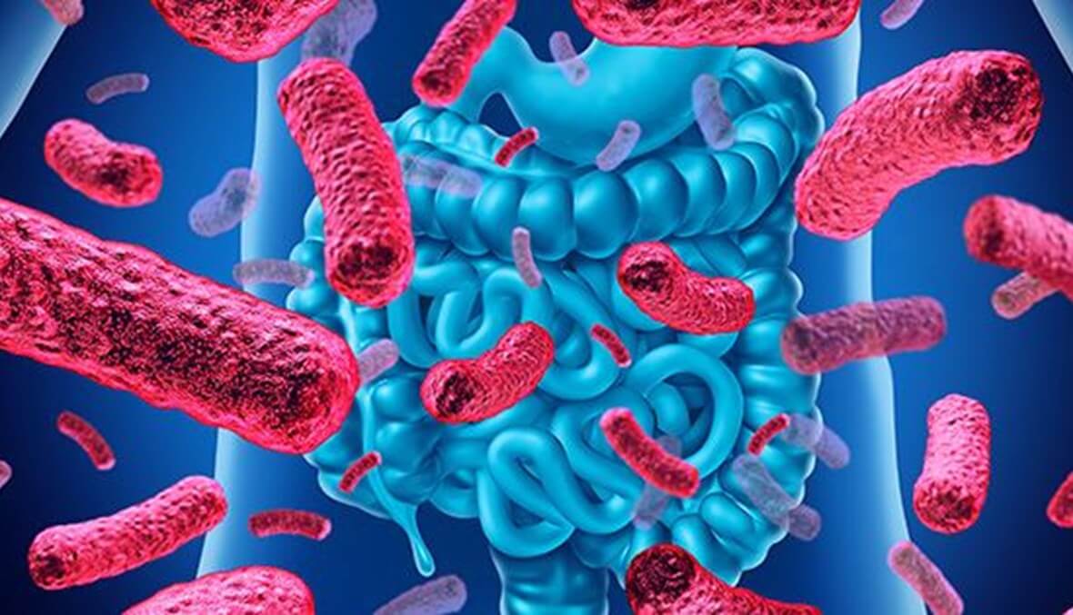 ما هي أعراض بكتيريا القولون؟