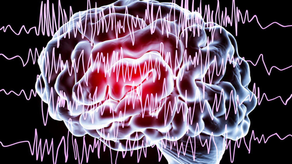 هل يمكن الشفاء من كهرباء المخ نهائياً؟