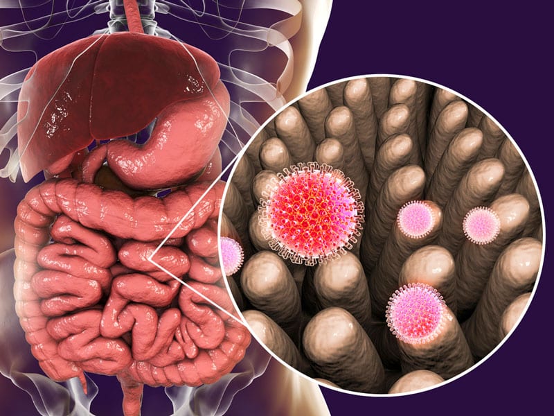 أقوى علاج لجرثومة المعدة