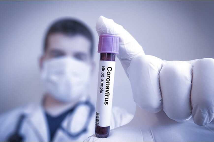 خبير طبي يدحض خمس خرافات حول فيروس كورونا المستجد!