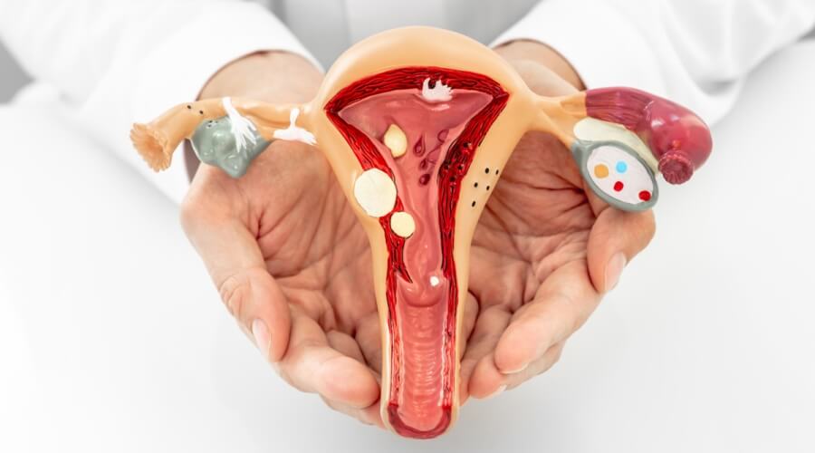 ما هي أعراض التصاقات الرحم بعد القيصرية؟
