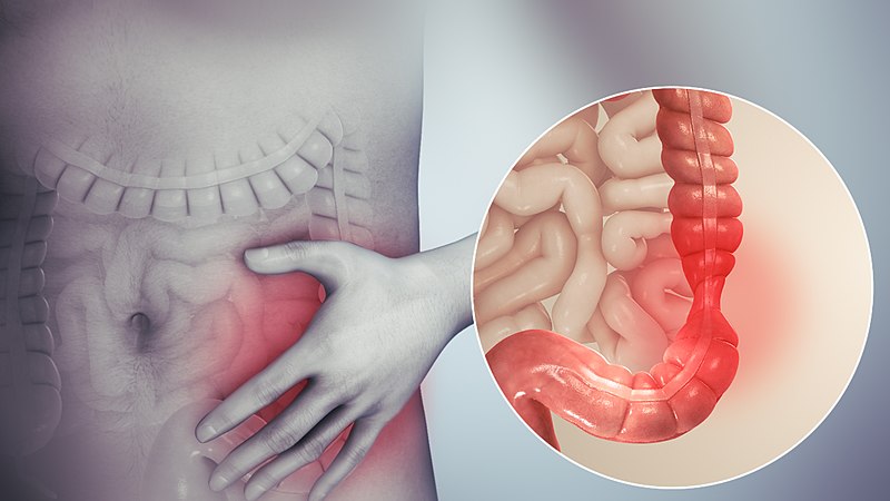 ما اعراض التهاب الجهاز الهضمي والأمعاء؟