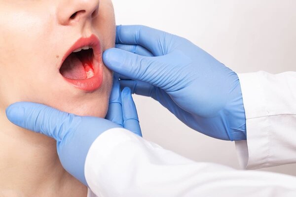 ما هي أسباب وعلاجات سرطان الفم؟