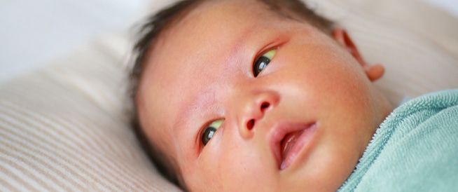 علامات الشفاء من اليرقان عند الرضع