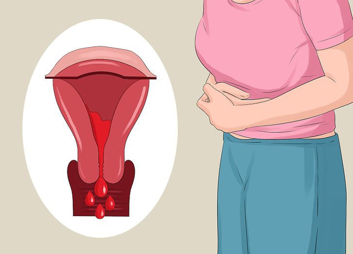 كيف انزل الدورة الشهرية اذا تأخرت بطرق طبيعية؟