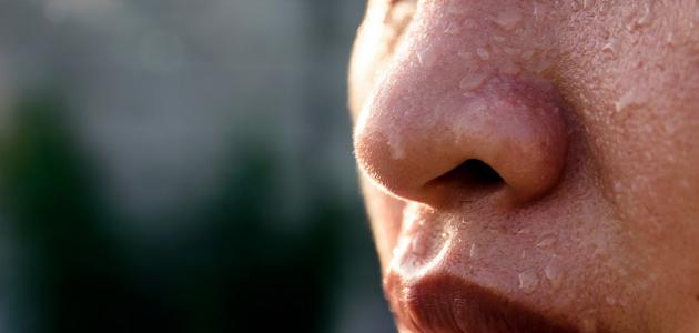 ما هو حل مشكلة التعرق الزائد في الوجه؟