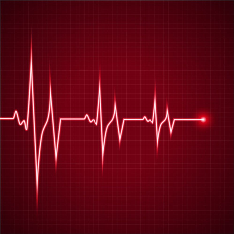 القلب الطبيعي نبضات مخطط معدل