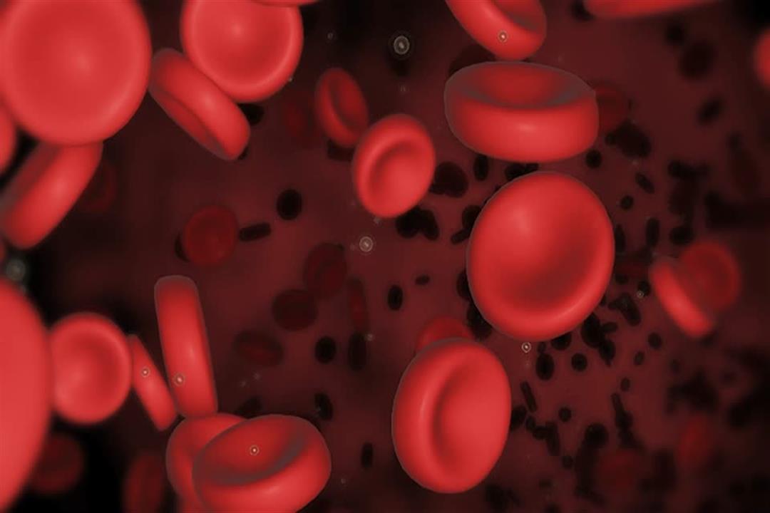ما هي اسباب نقص كريات الدم الحمراء والبيضاء؟
