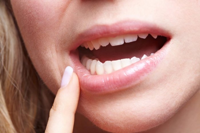 ما أسباب نزيف الدم من الفم؟