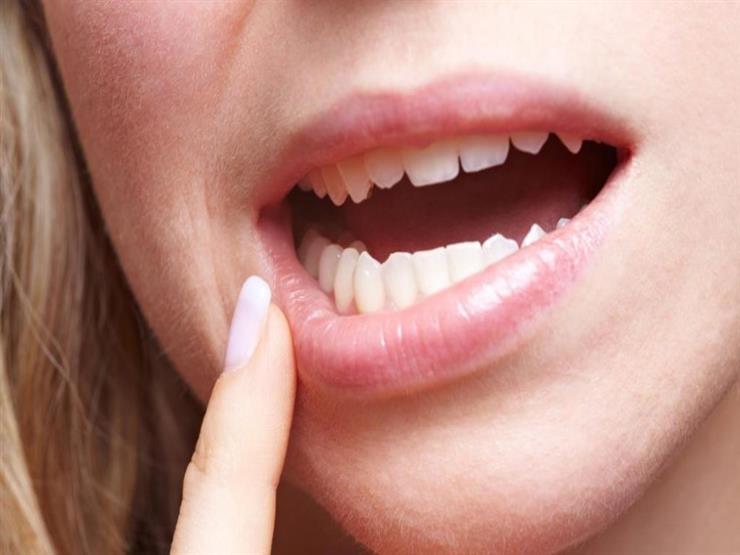 هل التهاب اللثة يسبب ألم الأسنان ؟