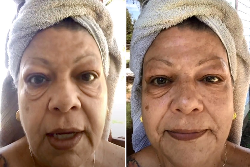 إمرأة تذهل متابعي تيك وتوك بمنتج سحري يزيل انتفاخ العين بثلاث دقائق