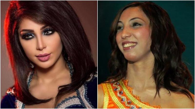 صور | ما هو عدد عمليات التجميل التي أجرتها أشهر النجمات العربيات؟