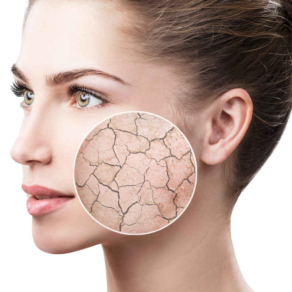 ما هي اسباب تشققات الجلد وعلامات التمدد؟