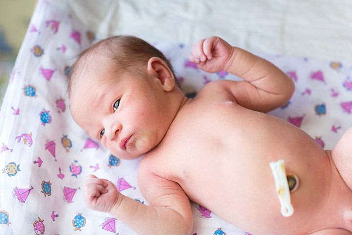أسباب الورم الحبيبي في سرة الرضيع