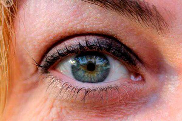 ما هي اعراض التهاب العصب البصري؟
