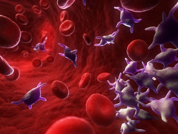 هل نقص الصفائح الدموية هو سرطان الدم؟ 